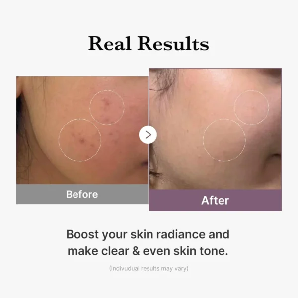 Medicube- Age-r Glutathione Glow Toner 140ml - Image 3