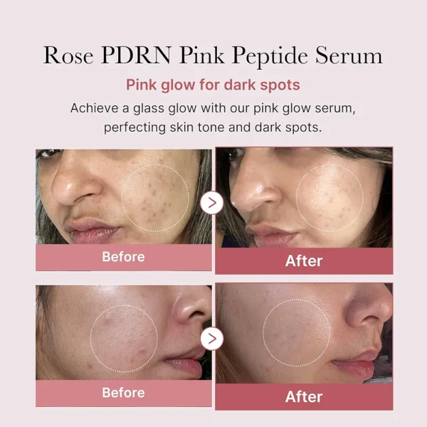 Medicube PDRN pdrn Pink Peptide Serum 30ml - Image 2
